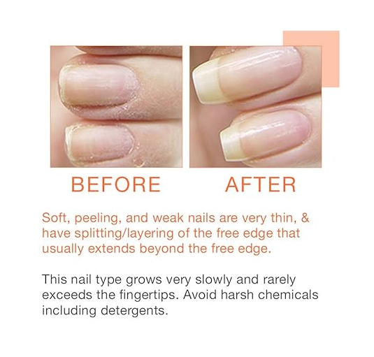 Nail Tek - Intensive Therapy 2